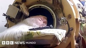 La mujer que vivió 73 años metida varias horas al día en un pulmón de acero que le permitía respirar
